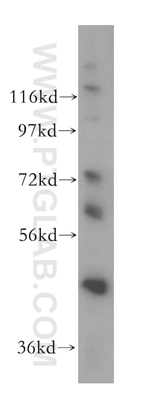 Western Blot (WB) analysis of A375 cells using DDX43 Polyclonal antibody (17591-1-AP)