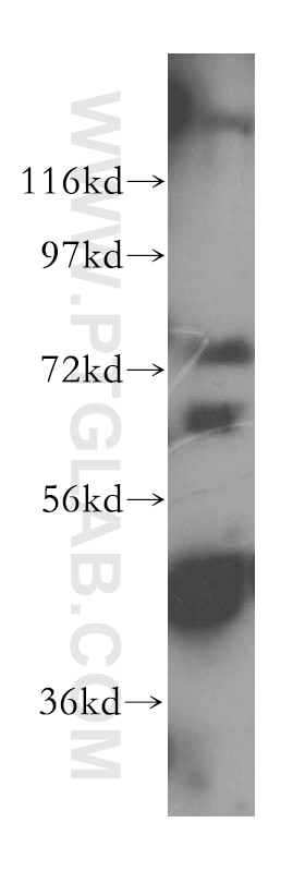 Western Blot (WB) analysis of PC-3 cells using DDX43 Polyclonal antibody (17591-1-AP)