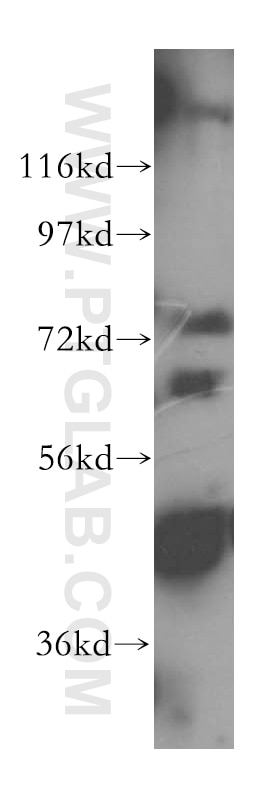 WB analysis of PC-3 using 17591-1-AP