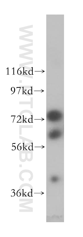 Western Blot (WB) analysis of HeLa cells using DDX43 Polyclonal antibody (17591-1-AP)