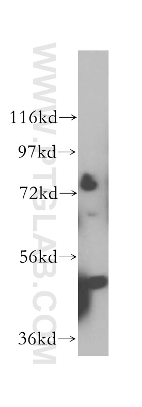Western Blot (WB) analysis of HepG2 cells using DDX43 Polyclonal antibody (17591-1-AP)