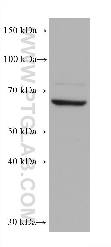 Western Blot (WB) analysis of various lysates using DDX43 Monoclonal antibody (68454-1-Ig)