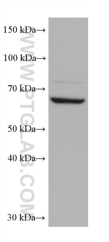 Western Blot (WB) analysis of various lysates using DDX43 Monoclonal antibody (68454-1-Ig)