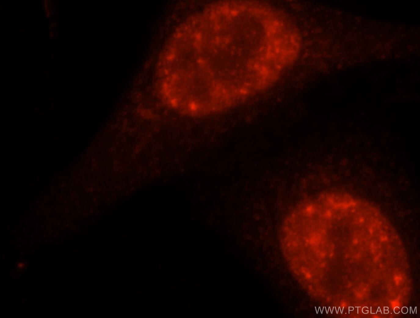 Immunofluorescence (IF) / fluorescent staining of HepG2 cells using DDX46 Polyclonal antibody (16927-1-AP)