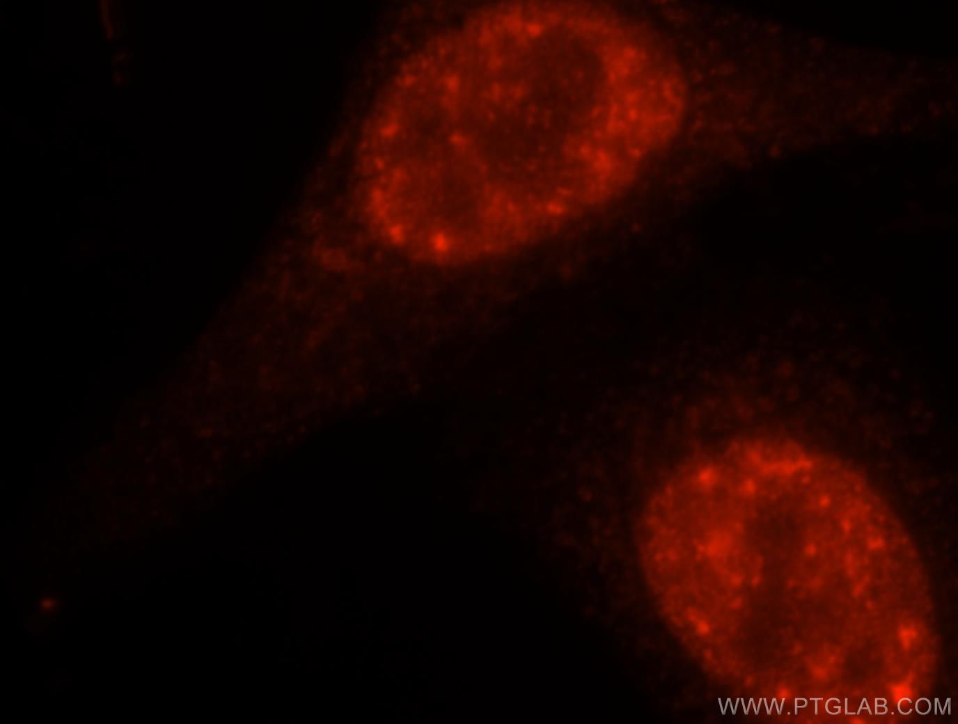 IF Staining of HepG2 using 16927-1-AP