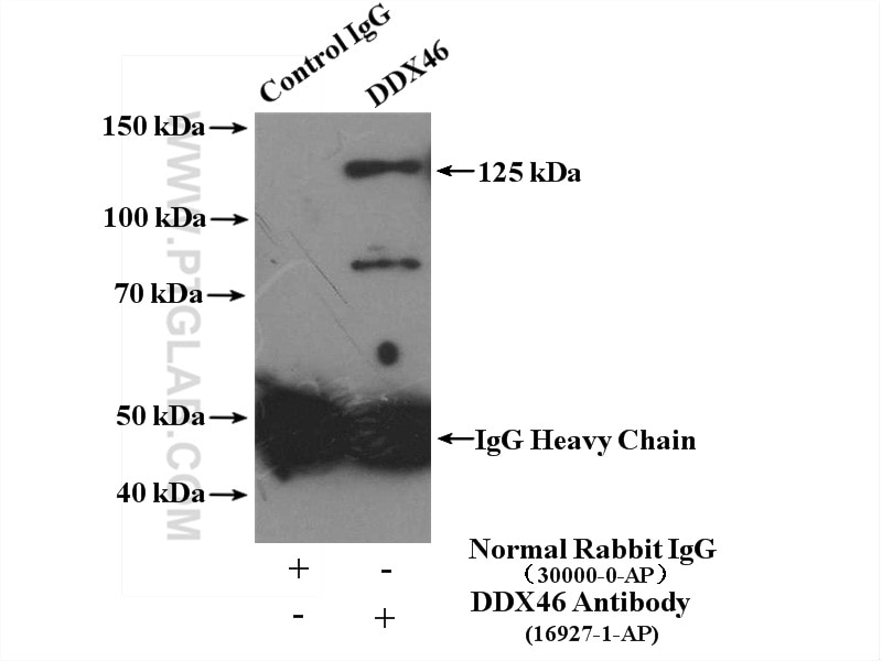 Immunoprecipitation (IP) experiment of NIH/3T3 cells using DDX46 Polyclonal antibody (16927-1-AP)