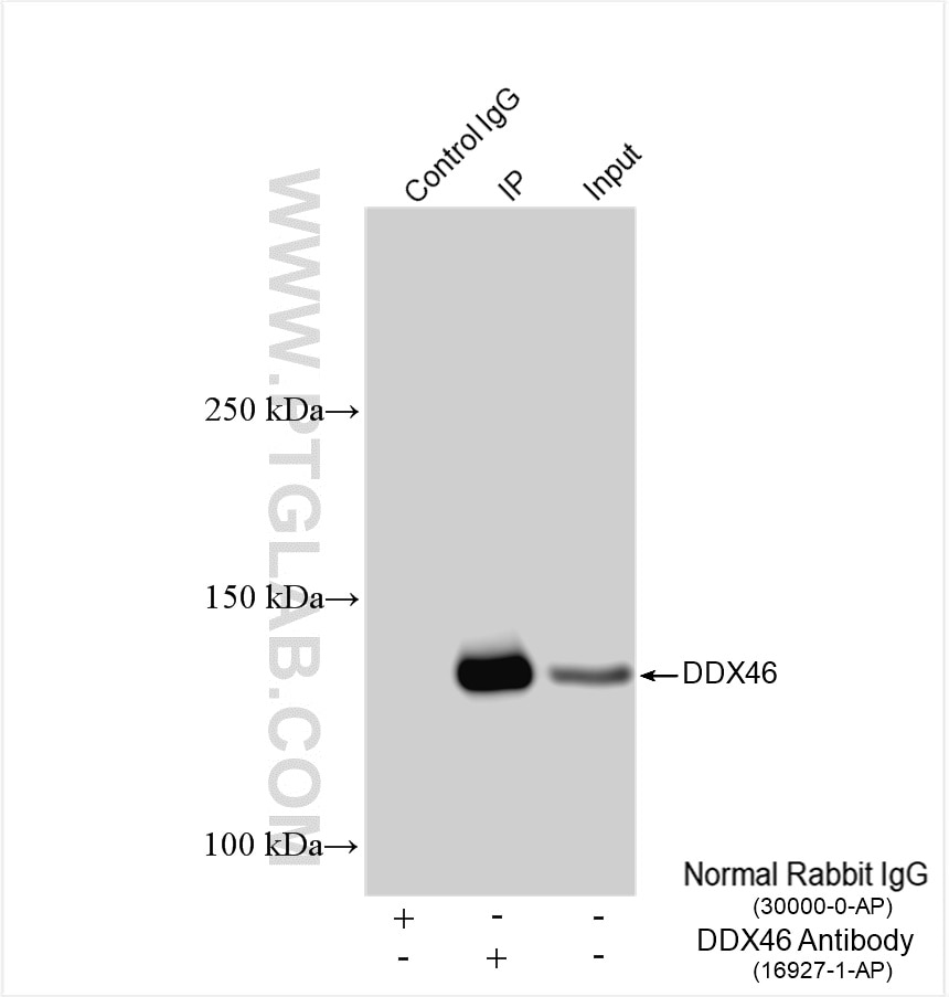 Immunoprecipitation (IP) experiment of HEK-293 cells using DDX46 Polyclonal antibody (16927-1-AP)