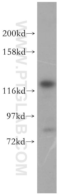 Western Blot (WB) analysis of NIH/3T3 cells using DDX46 Polyclonal antibody (16927-1-AP)