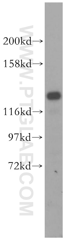 Western Blot (WB) analysis of HEK-293 cells using DDX46 Polyclonal antibody (16927-1-AP)