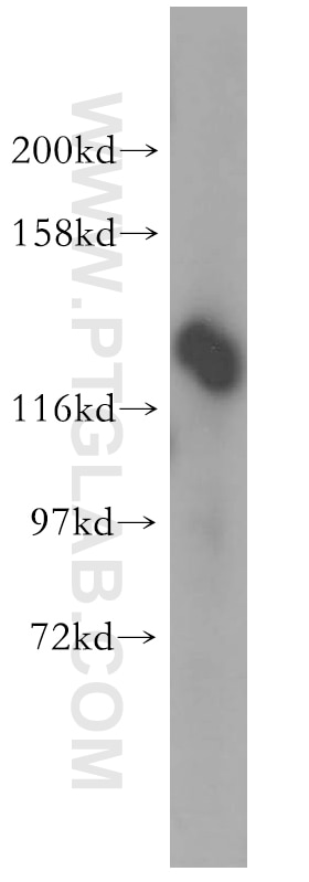 Western Blot (WB) analysis of HeLa cells using DDX46 Polyclonal antibody (16927-1-AP)