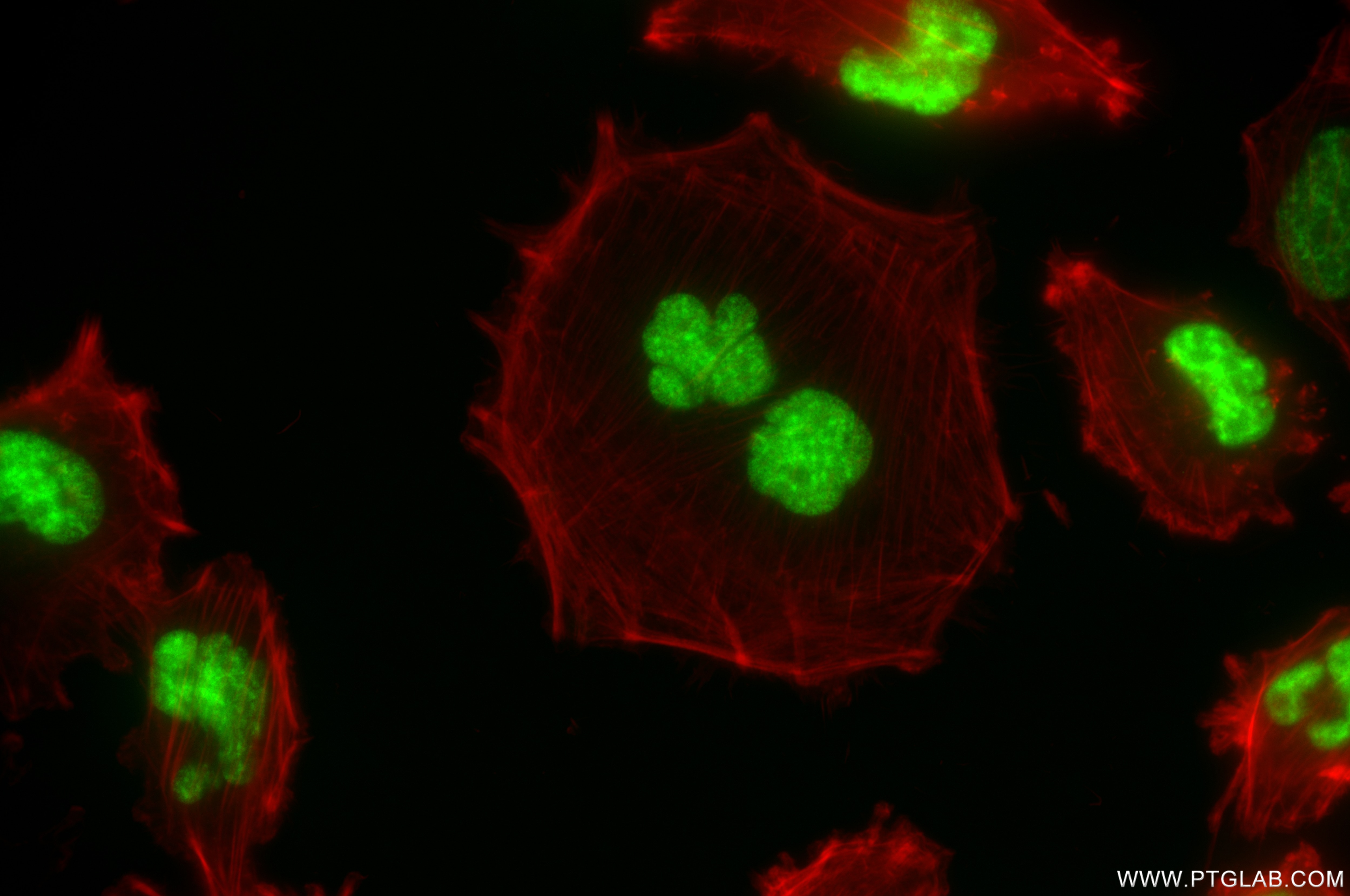 Immunofluorescence (IF) / fluorescent staining of U-251 cells using DDX46 Recombinant antibody (85065-3-RR)