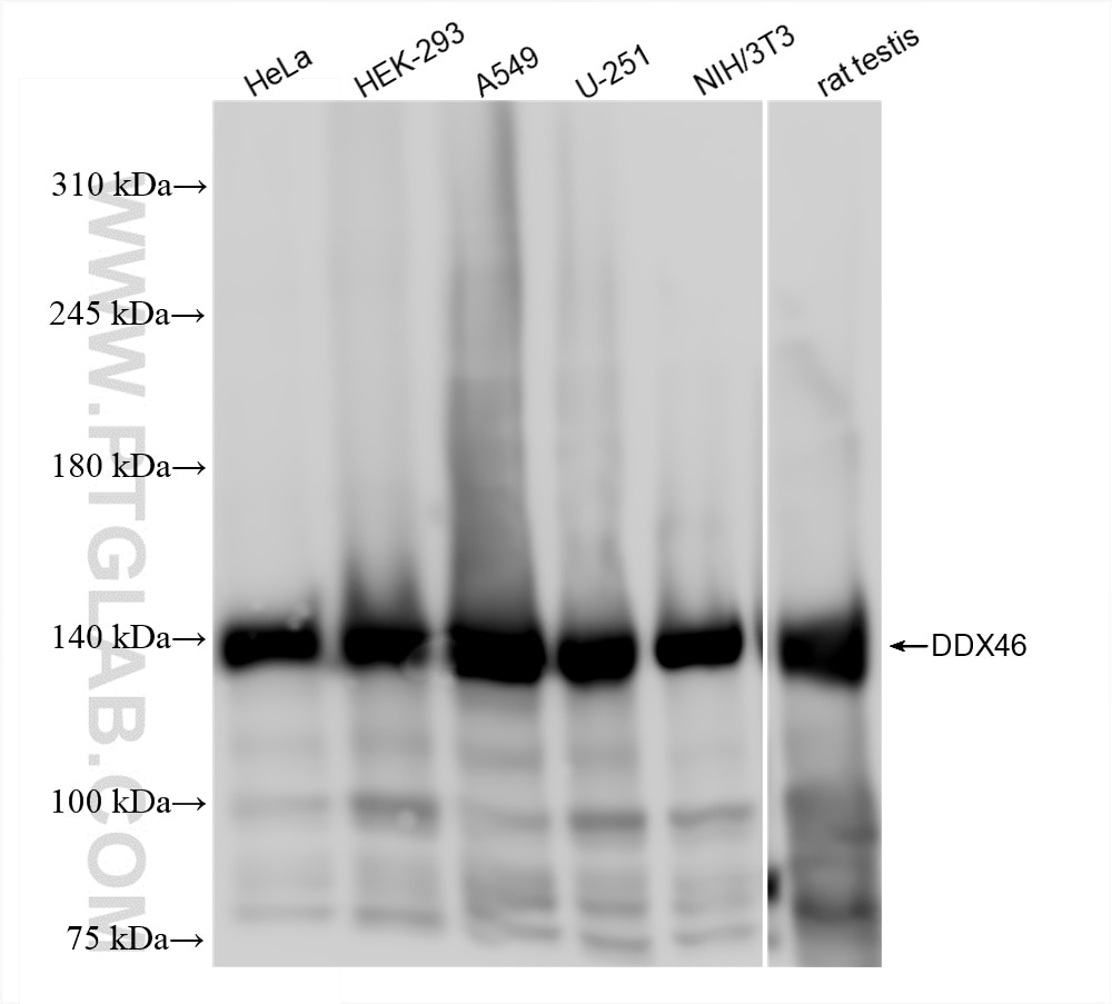 Western Blot (WB) analysis of various lysates using DDX46 Recombinant antibody (85065-3-RR)