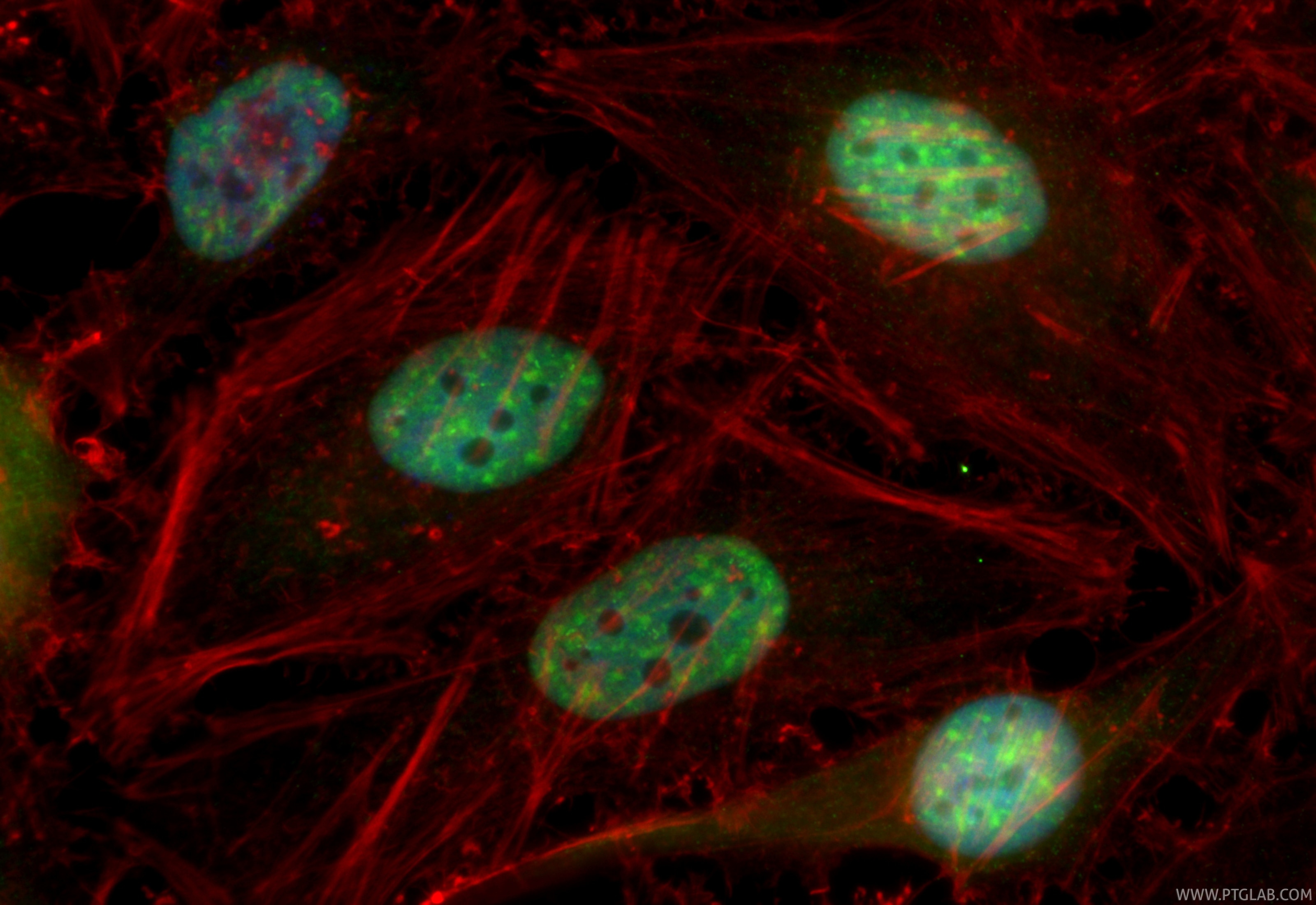 Immunofluorescent analysis of (4% PFA) fixed HeLa cells using CoraLite® Plus 488 DDX46 antibody (CL488-85065-3, Clone: 242715E10 ) at dilution of 1:200, CL594-phalloidin (red). Immunofluorescence (IF) / fluorescent staining of HeLa cells using CoraLite® Plus 488-conjugated DDX46 Recombinant mo (CL488-85065-3)