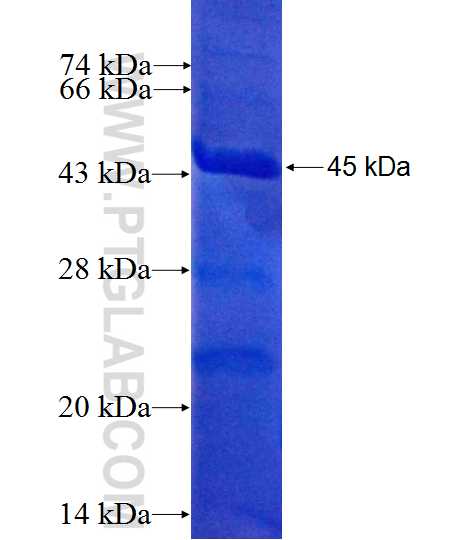 DDX46 fusion protein Ag10465 SDS-PAGE