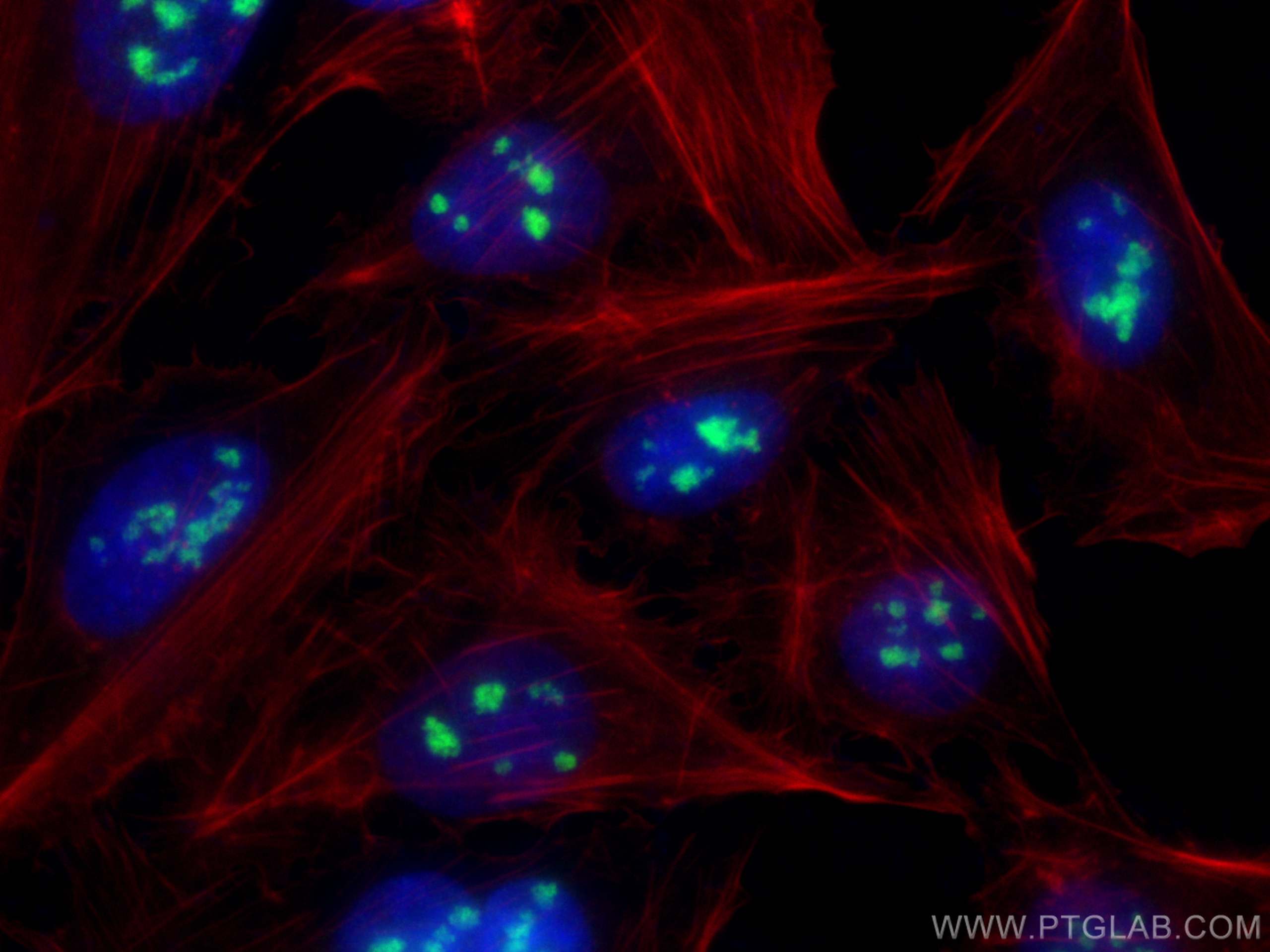 Immunofluorescence (IF) / fluorescent staining of U2OS cells using DDX47 Polyclonal antibody (17795-1-AP)