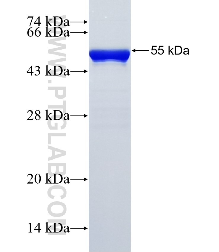 DDX47 fusion protein Ag35438 SDS-PAGE DDX47 fusion protein Ag35438 SDS-PAGE