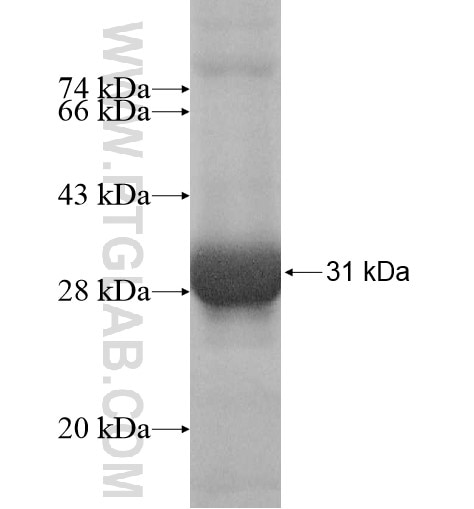 DDX47 fusion protein Ag11953 SDS-PAGE