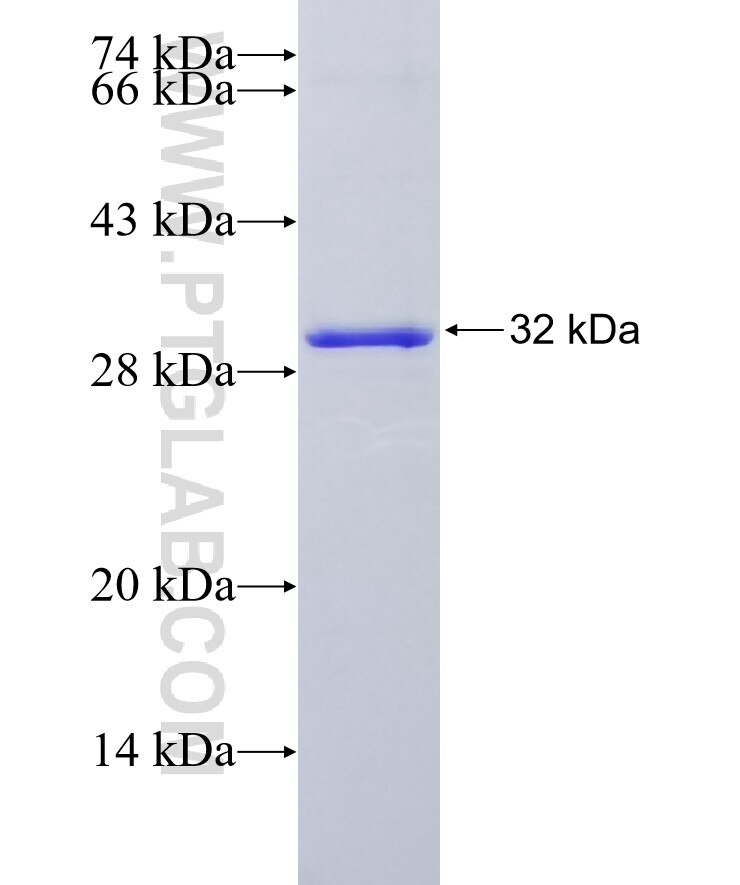 DDX47 fusion protein Ag11953 SDS-PAGE