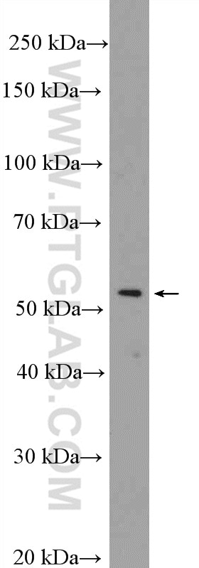 Western Blot (WB) analysis of HeLa cells using DDX49 Polyclonal antibody (20523-1-AP)