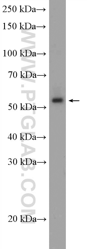 Western Blot (WB) analysis of Y79 cells using DDX49 Polyclonal antibody (20523-1-AP)