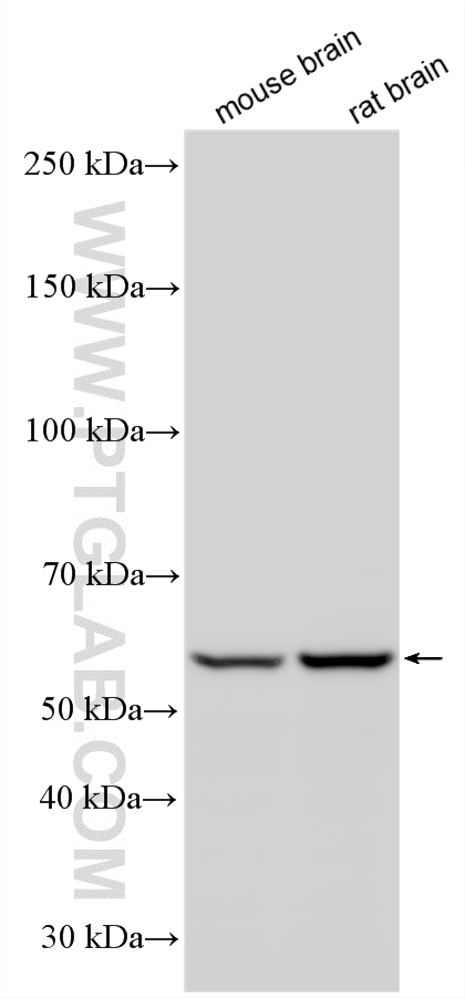Western Blot (WB) analysis of various lysates using DDX49 Polyclonal antibody (20523-1-AP)