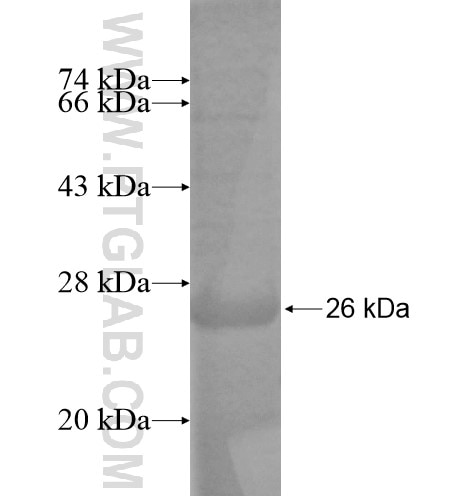 DDX49 fusion protein Ag14373 SDS-PAGE