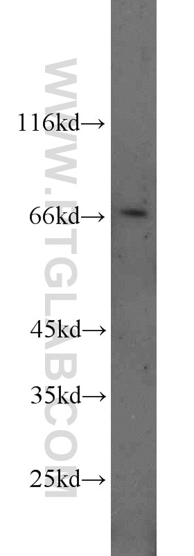 Western Blot (WB) analysis of A431 cells using DDX5,p68 Polyclonal antibody (10804-1-AP)