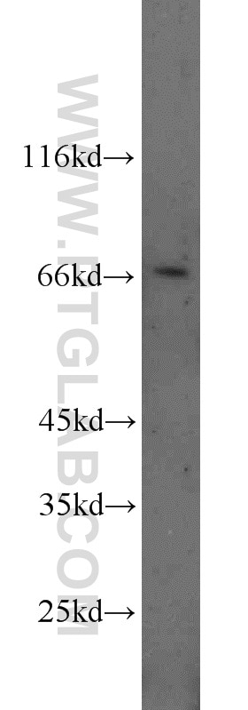 Western Blot (WB) analysis of A431 cells using DDX5 Polyclonal antibody (10804-1-AP)