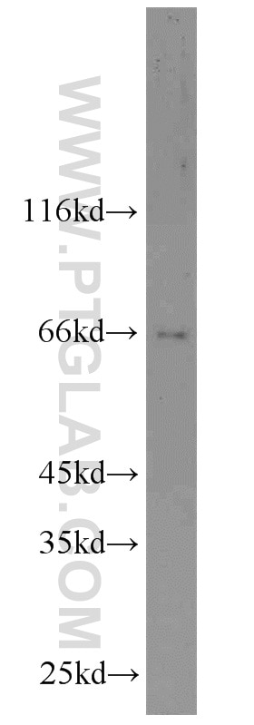 Western Blot (WB) analysis of NIH/3T3 cells using DDX5 Polyclonal antibody (10804-1-AP)