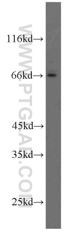 Western Blot (WB) analysis of HeLa cells using DDX5,p68 Polyclonal antibody (10804-1-AP)