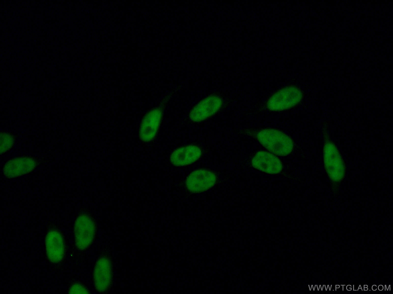 Immunofluorescence (IF) / fluorescent staining of HepG2 cells using DDX5 Polyclonal antibody (26385-1-AP)
