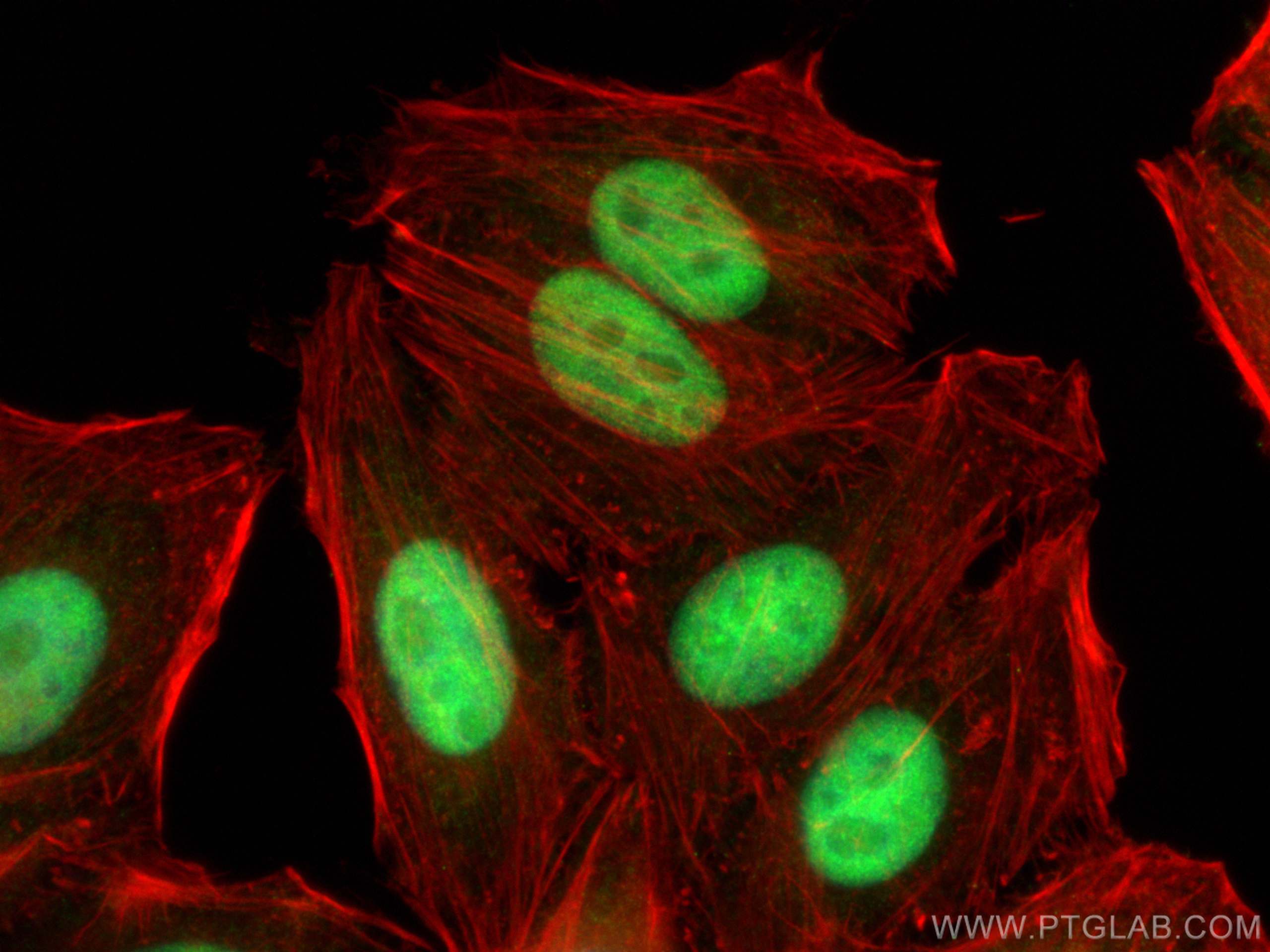 IF Staining of HepG2 using 26385-1-AP