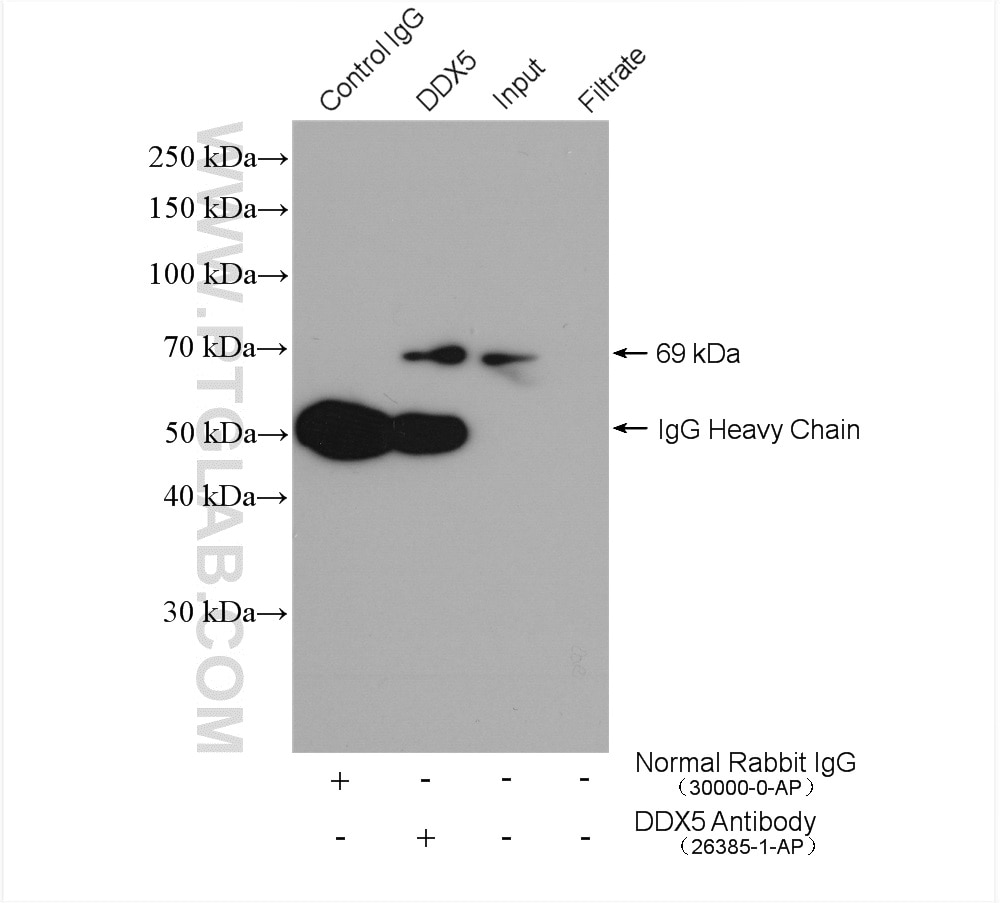 Immunoprecipitation (IP) experiment of HeLa cells using DDX5 Polyclonal antibody (26385-1-AP)