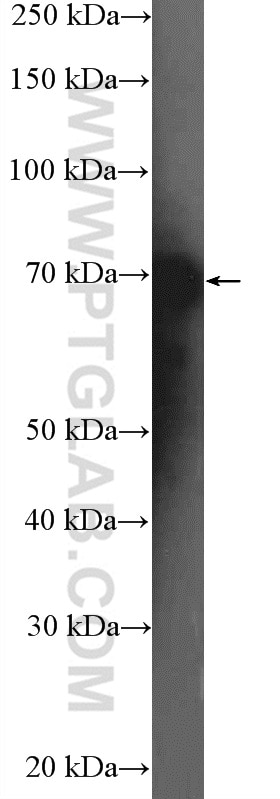 Western Blot (WB) analysis of HeLa cells using DDX5 Polyclonal antibody (26385-1-AP)