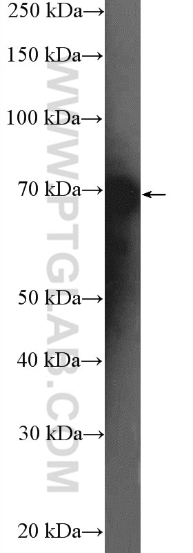 WB analysis of HeLa using 26385-1-AP