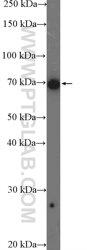 Western Blot (WB) analysis of HepG2 cells using DDX5 Polyclonal antibody (26385-1-AP)