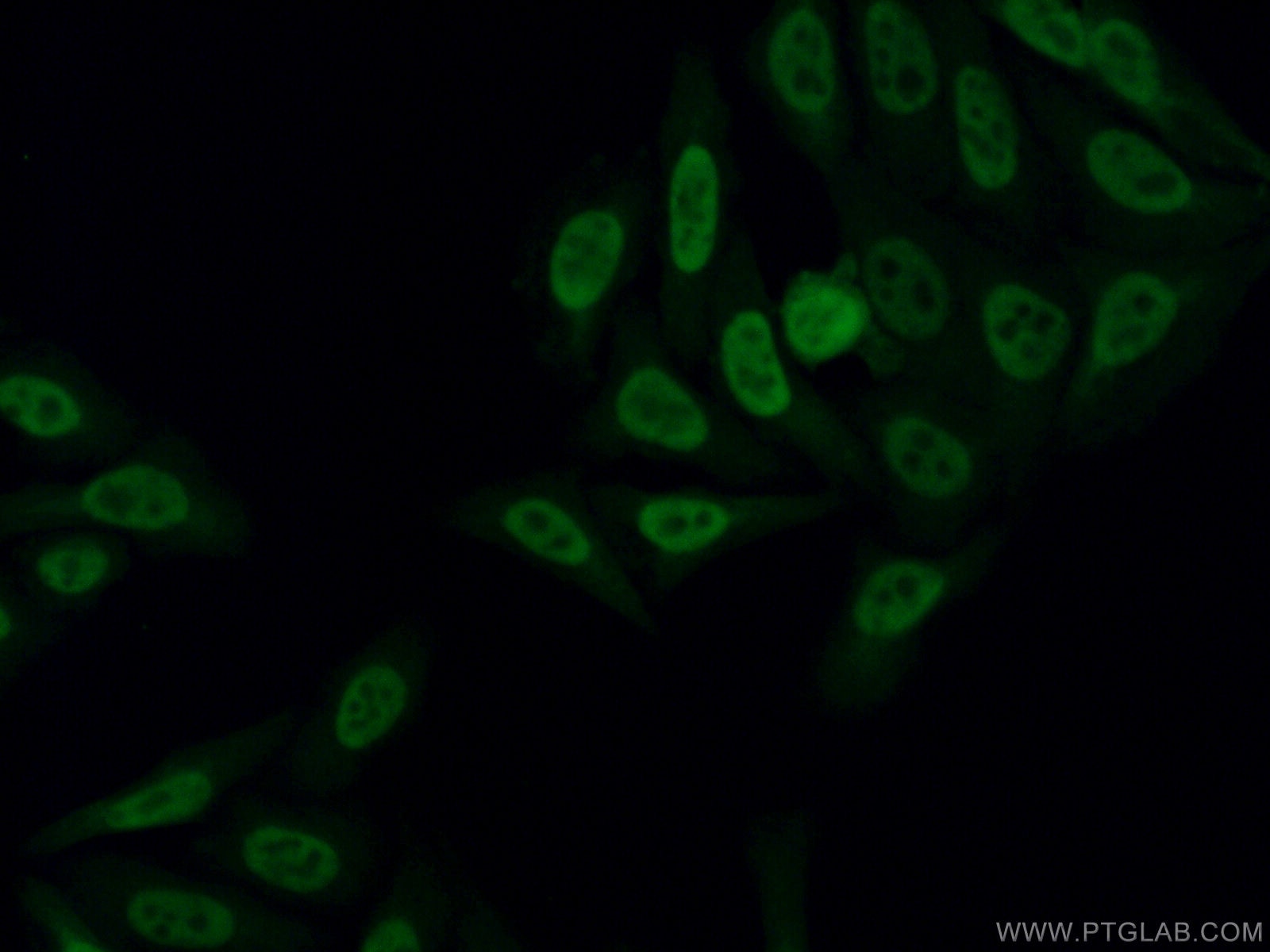 Immunofluorescence (IF) / fluorescent staining of HepG2 cells using DDX5 Monoclonal antibody (67025-1-Ig)