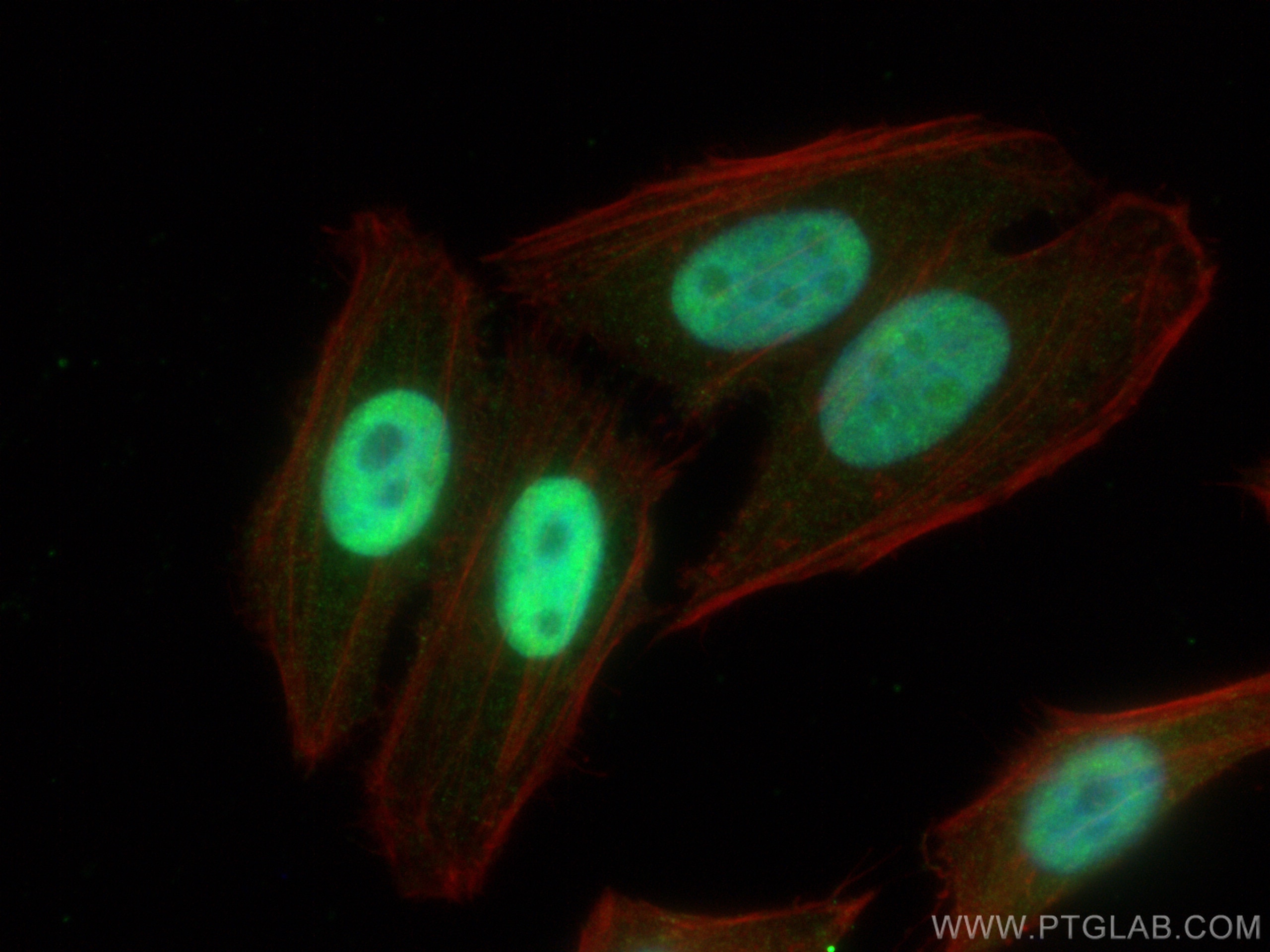 Immunofluorescence (IF) / fluorescent staining of HepG2 cells using DDX5 Monoclonal antibody (67025-1-Ig)