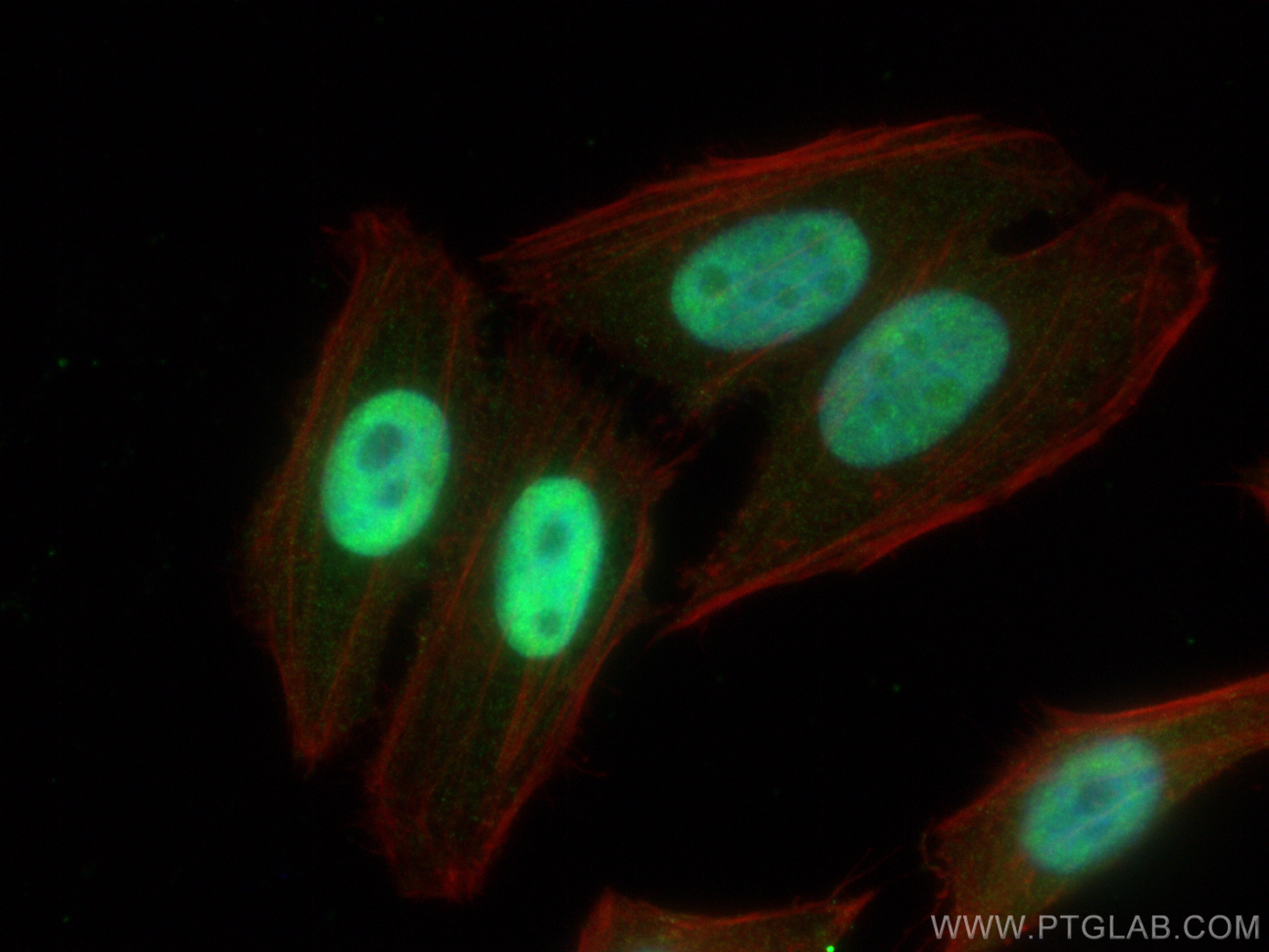 IF Staining of HepG2 using 67025-1-Ig