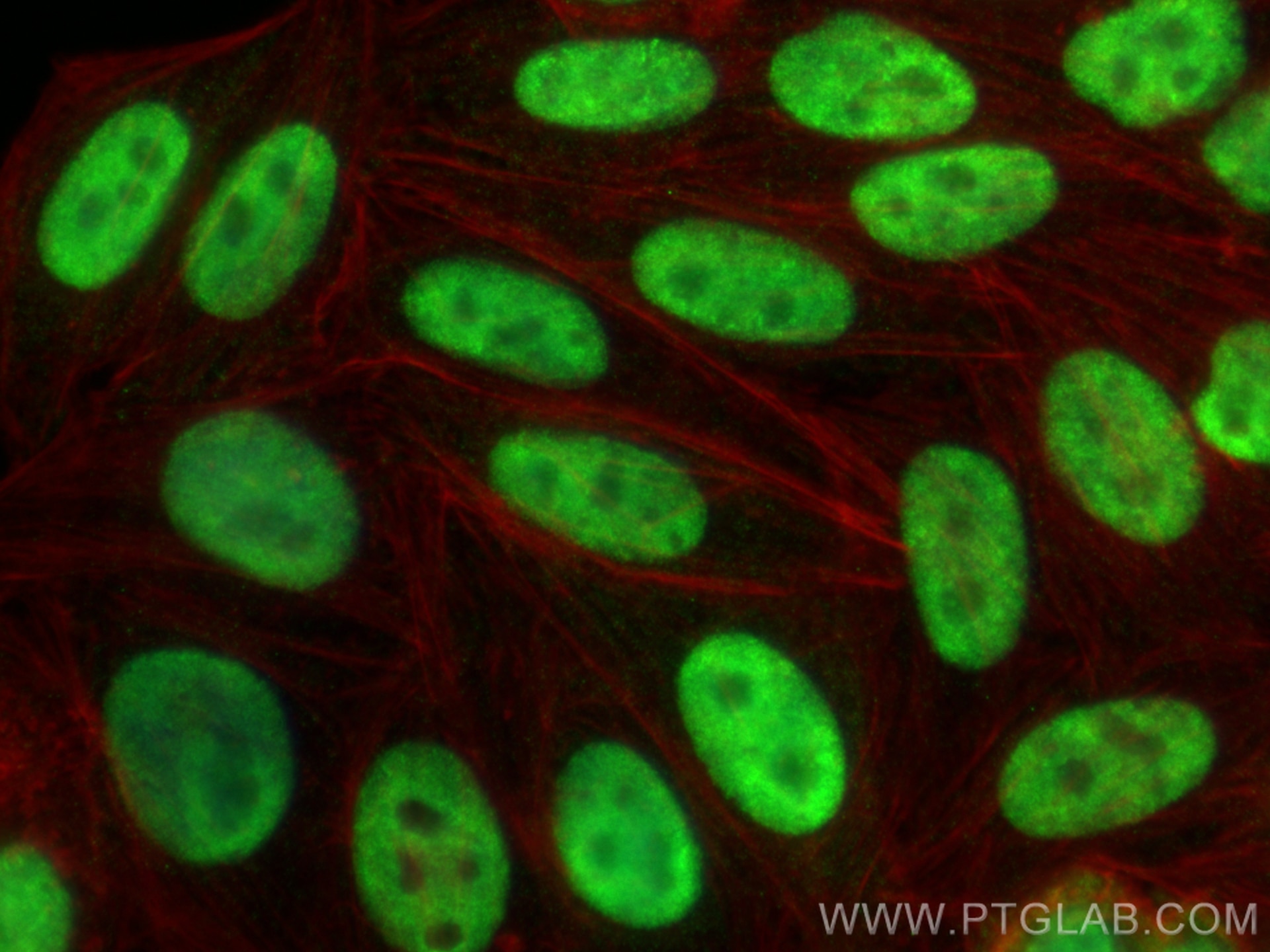 Immunofluorescence (IF) / fluorescent staining of HepG2 cells using DDX5 Monoclonal antibody (67025-1-Ig)