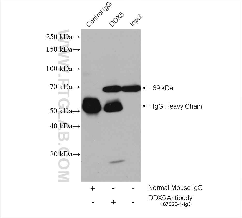 Immunoprecipitation (IP) experiment of HeLa cells using DDX5 Monoclonal antibody (67025-1-Ig)
