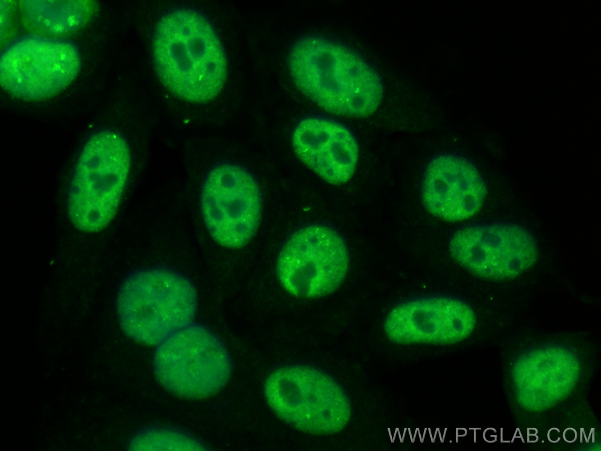 Immunofluorescence (IF) / fluorescent staining of HepG2 cells using CoraLite® Plus 488-conjugated DDX5 Monoclonal anti (CL488-67025)