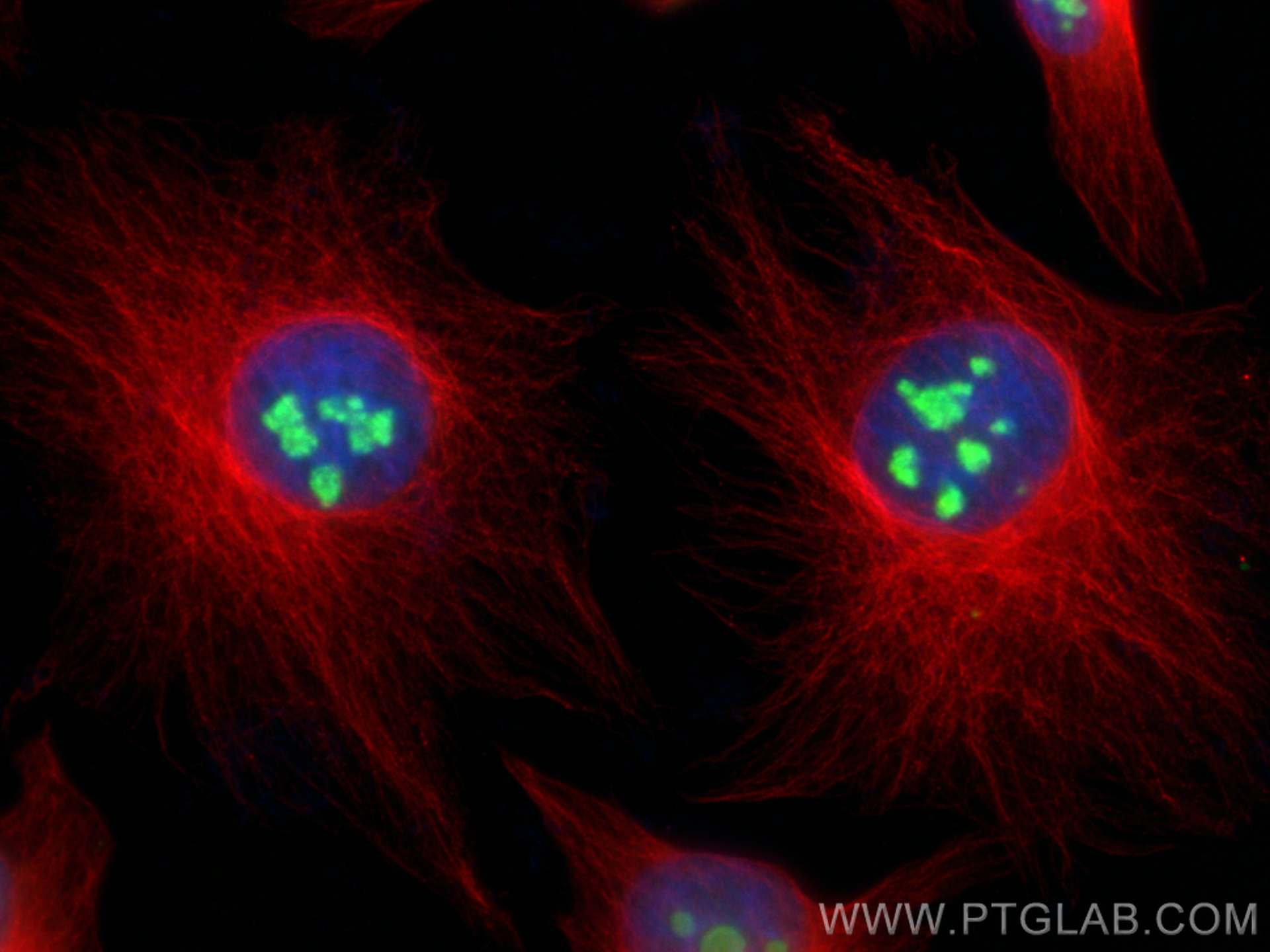Immunofluorescence (IF) / fluorescent staining of HeLa cells using DDX50 Polyclonal antibody (10358-1-AP)