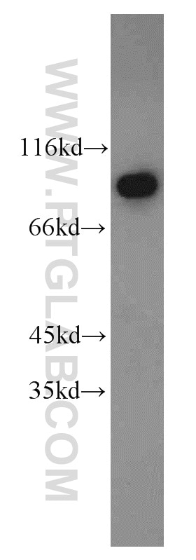 Western Blot (WB) analysis of HeLa cells using DDX50 Polyclonal antibody (10358-1-AP)