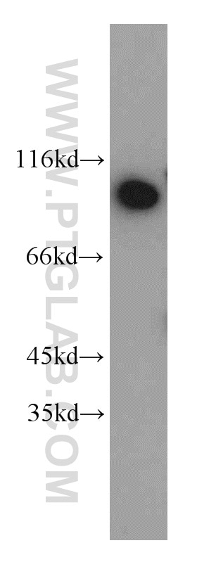 Western Blot (WB) analysis of Jurkat cells using DDX50 Polyclonal antibody (10358-1-AP)
