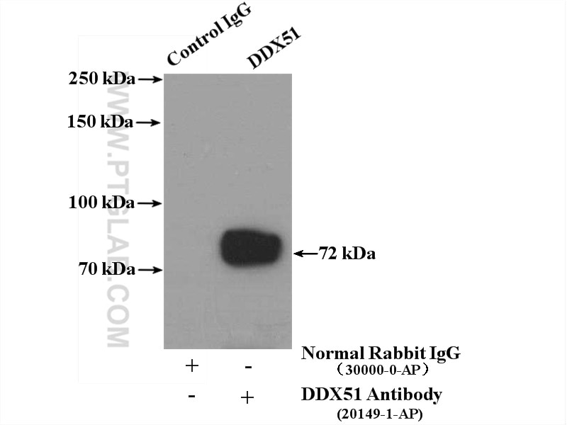 Immunoprecipitation (IP) experiment of K-562 cells using DDX51 Polyclonal antibody (20149-1-AP)