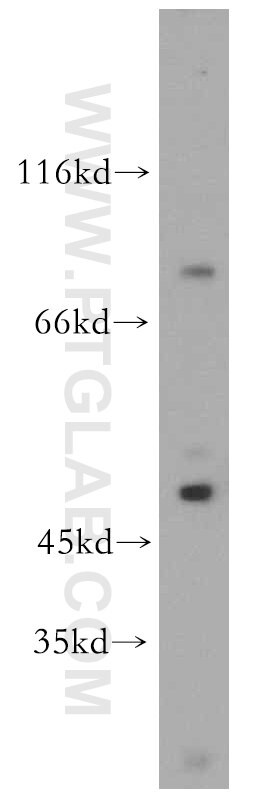 Western Blot (WB) analysis of Jurkat cells using DDX51 Polyclonal antibody (20149-1-AP)