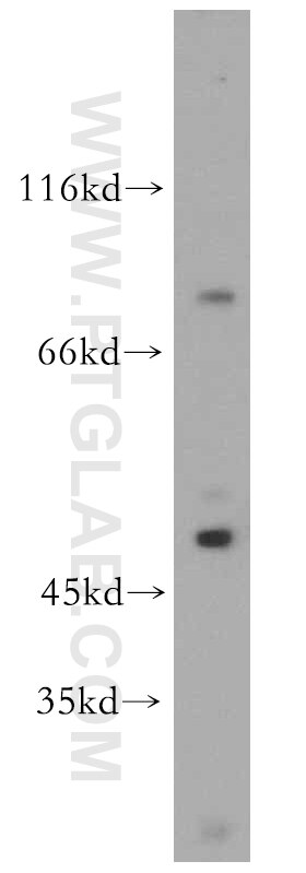 WB analysis of Jurkat using 20149-1-AP