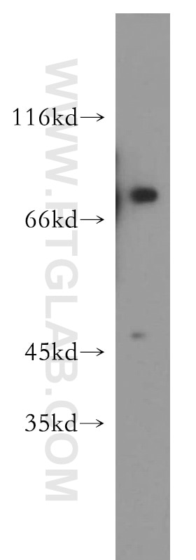 Western Blot (WB) analysis of K-562 cells using DDX51 Polyclonal antibody (20149-1-AP)