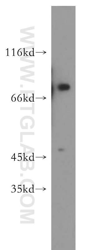 WB analysis of K-562 using 20149-1-AP